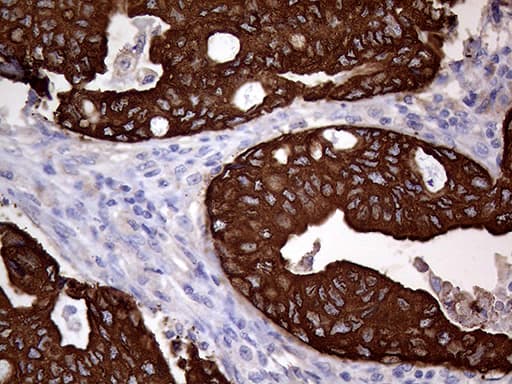 AGR2 Antibody (aa21-175, clone OTI3B5, Carrier-free)