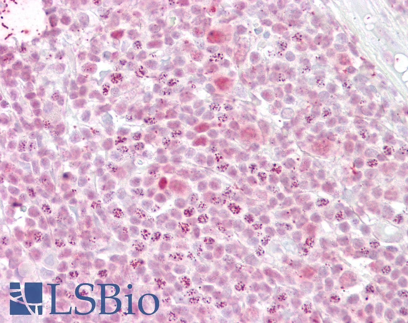 IHC-plus™ Polyclonal Goat anti-Human IKZF1 / IKAROS Antibody (aa290-303, IHC, WB)