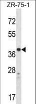 CYSLTR1 / CYSLT1 Antibody (aa144-172)