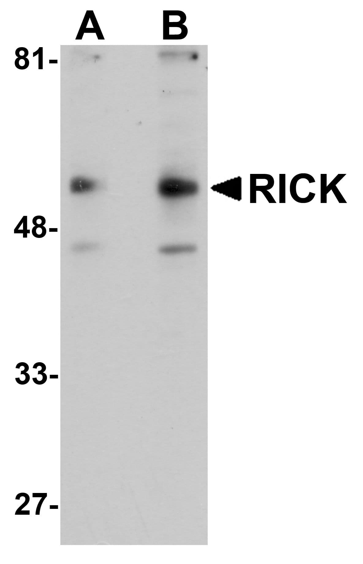 IHC-plus™ Polyclonal Rabbit anti-Human RICK / RIP2 Antibody (IHC, IF, WB)