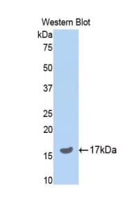 SERPINA6 / CBG Antibody (aa267-390, PE)