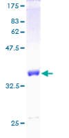 Human S100A1 / S100-A1 Protein (Recombinant GST)