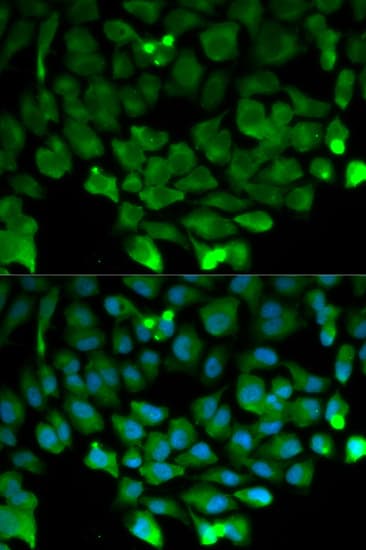 CUL3 / Cullin 3 Antibody