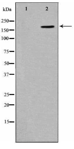 EMA / MUC1 Antibody (phospho-Tyr1229)