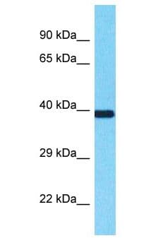 Polyclonal Rabbit anti-Human SEC13 Antibody (aa101-150, WB)
