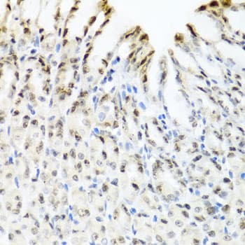 Polyclonal Rabbit anti-Human YTHDF3 Antibody (IHC, WB)