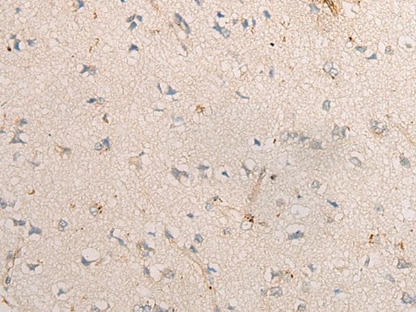 PPM1D / WIP1 Antibody