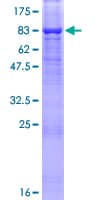 Human SPINT1 / HAI-1 Protein (Recombinant GST)
