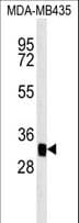 MTCH2 Antibody (aa75-103)