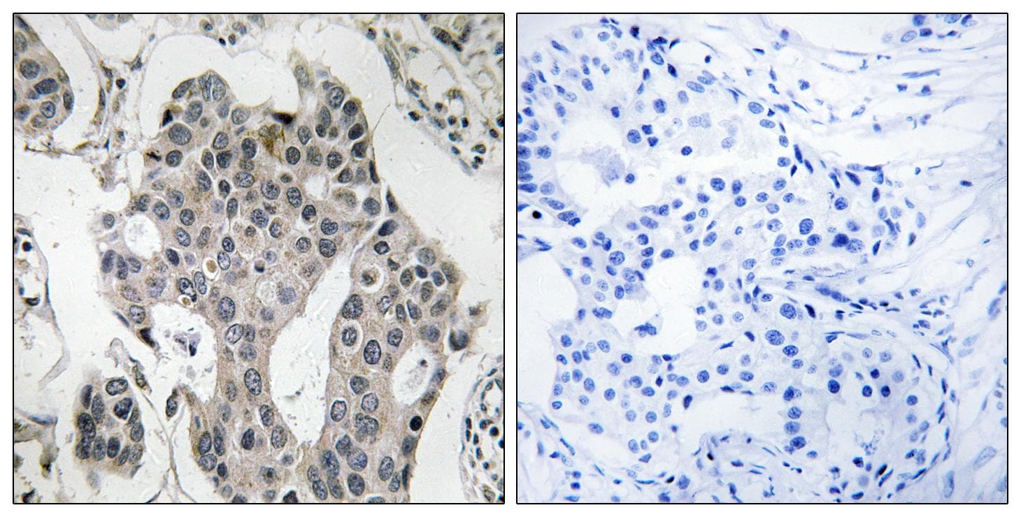 RAB3GAP2 / p150 Antibody