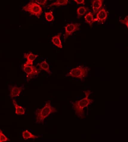 Polyclonal Rabbit anti-Human CD27L / CD70 Antibody (IF, WB)