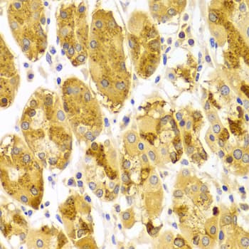 PRKCE / PKC-Epsilon Antibody