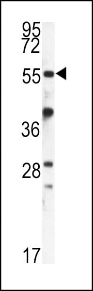 FKBP9 Antibody (aa51-80)