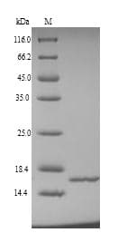 Human NHP2L1 Protein (Recombinant 6His, N-terminus)