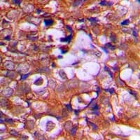 PTEN Antibody (C-Terminus)