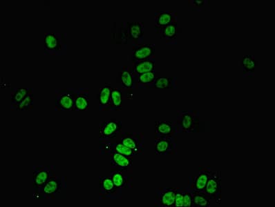 PPP1R8 / Rnase E Antibody