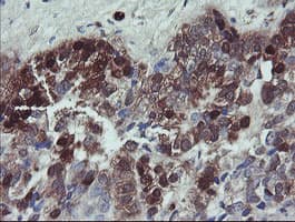 TSC22D1 / TSC22 Antibody (clone OTI1A5)