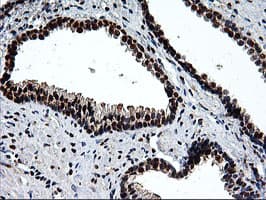 EPM2AIP1 Antibody (clone OTI1G9)