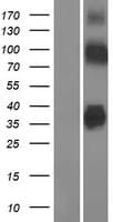 SLC30A8 / ZNT8 Protein (Over-Expression Lysate Myc-DDK (Flag))
