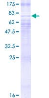 Human SLC2A2 / GLUT2 Protein (Recombinant GST)