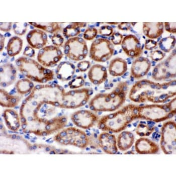 HSPA9 / Mortalin / GRP75 Antibody (aa646-679)