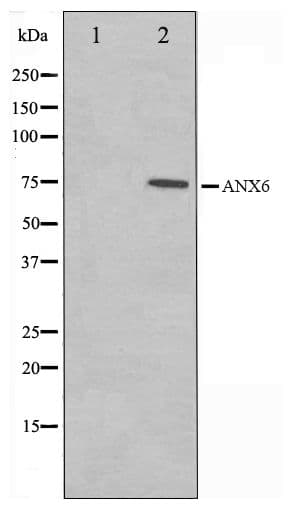 ANXA6/Annexin A6/Annexin VI Antibody