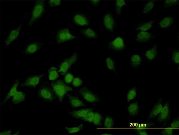 IHC-plus™ IRAK1 / IRAK Antibody (clone 3F7)