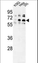 Polyclonal Rabbit anti-Human TRIP13 Antibody (aa64-90, IHC, WB)