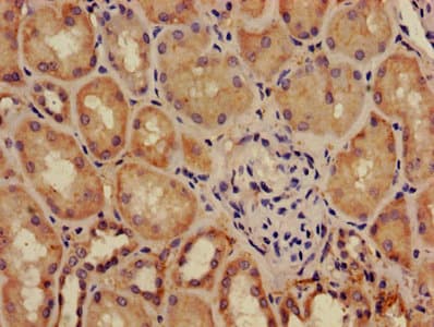 Polyclonal Rabbit anti-Human ADM / Adrenomedullin Antibody (aa45-92, IHC)