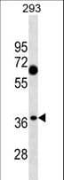 Polyclonal Rabbit anti-Human C1QTNF7 / CTRP7 Antibody (aa3-31, WB)