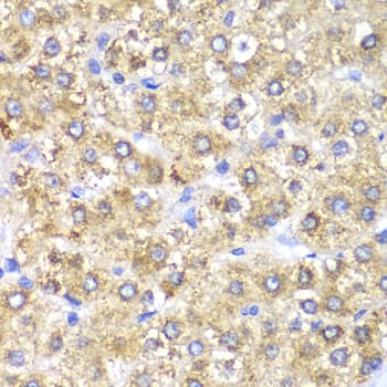 IHC-plus™ SHMT / SHMT2 Antibody