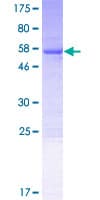 Human VPS37B Protein (Recombinant GST)