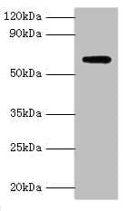 Polyclonal Rabbit anti-Human AMHR2 / MISRII Antibody (aa18-149, IHC, WB)