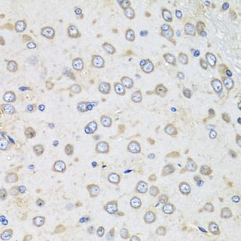 ALB / Serum Albumin Antibody