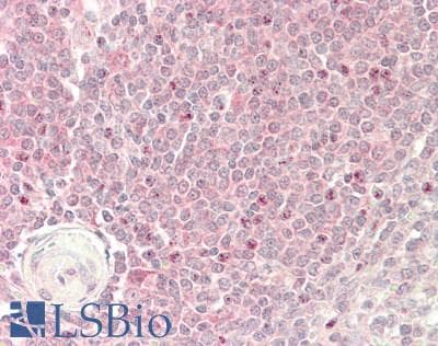 C1GALT1 Antibody (aa251-300)