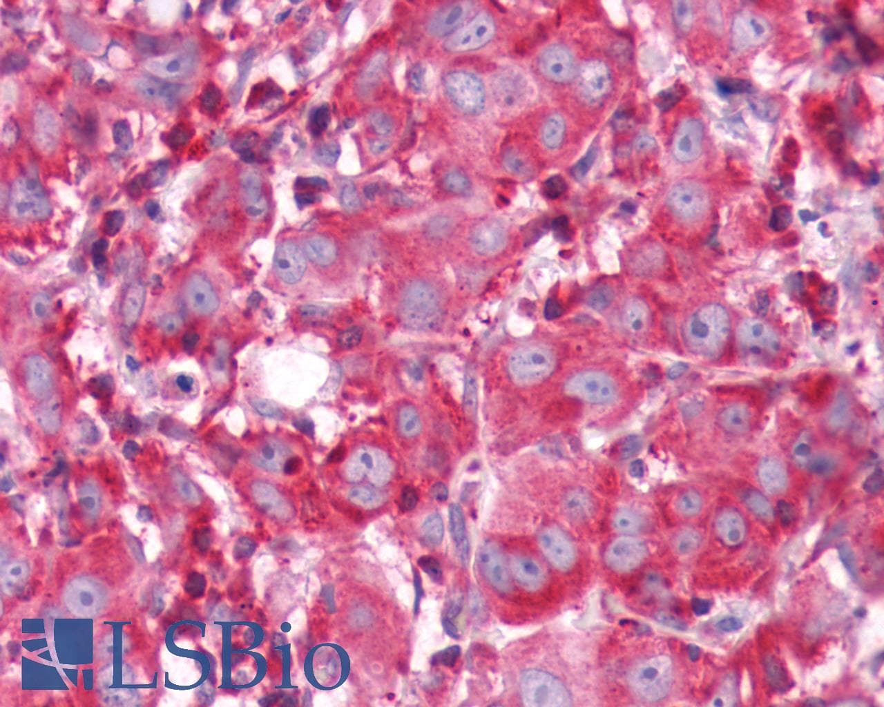 PathPlus™ ADORA1 / Adenosine A1 Receptor Antibody (Cytoplasmic Domain)