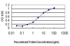 DNAJB2 Antibody (clone 2C9)