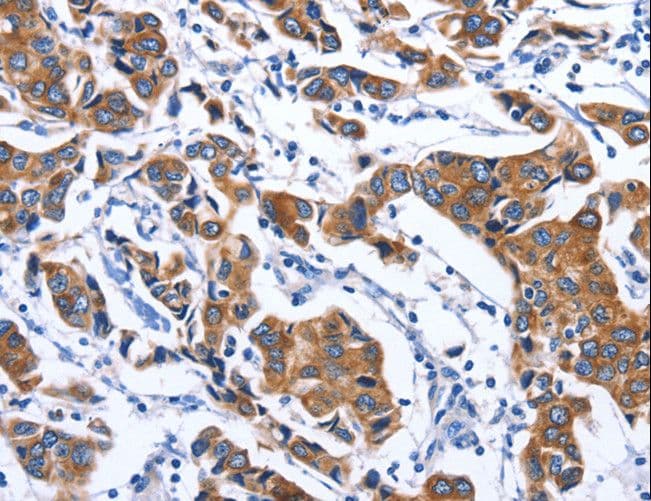 MYH1 Antibody