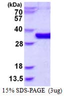 Human MEMO1 Protein (Recombinant His)