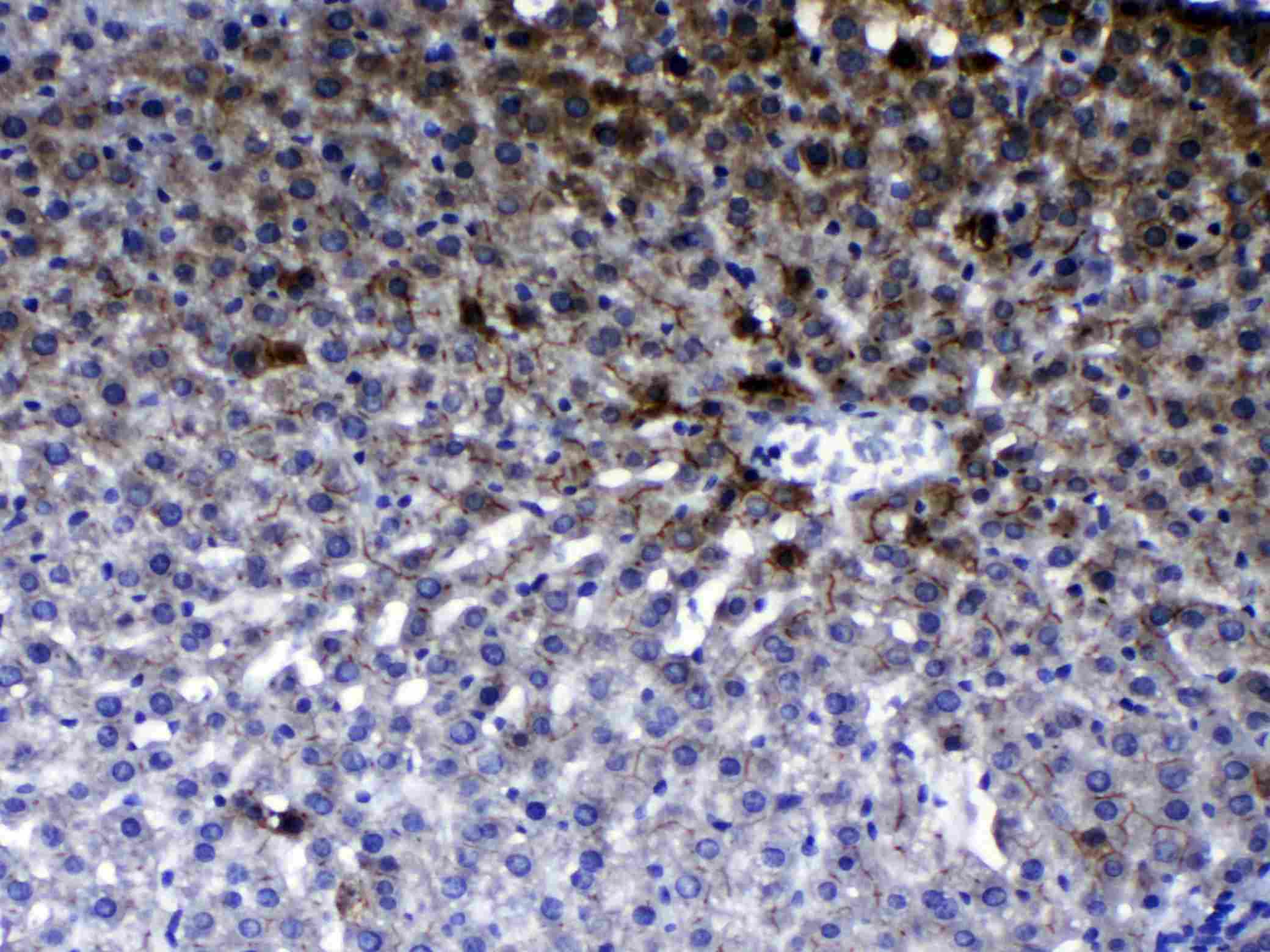Polyclonal Rabbit anti-Human ERBB2 / HER2 Antibody (IHC, WB)