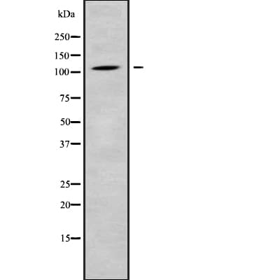 Polyclonal Rabbit anti-Human CLCN1 / CLC-1 Antibody (WB)