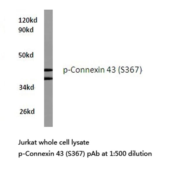 GJA1 / CX43 / Connexin 43 Antibody (phospho-Ser367)