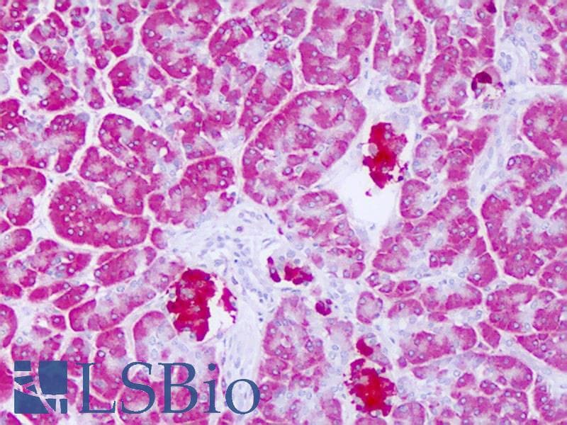 LYPLAL1 Antibody (C-Terminus)