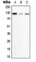Polyclonal Rabbit anti-Human PHKB Antibody (Internal, WB)