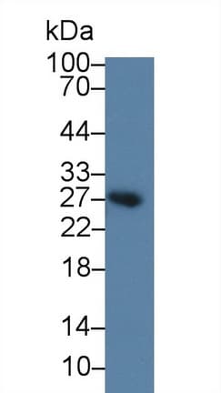 BAFF Receptor / CD268 Antibody (aa3-175)