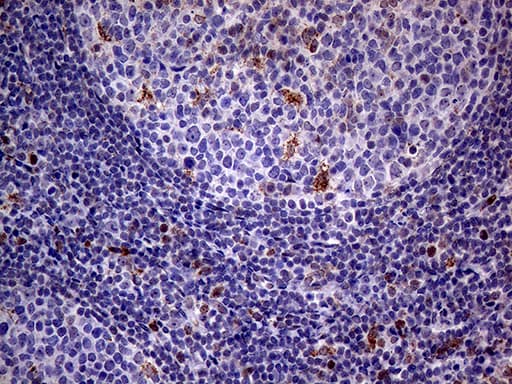 ALDP / ABCD1 Antibody (aa508-745, clone OTI3A1)