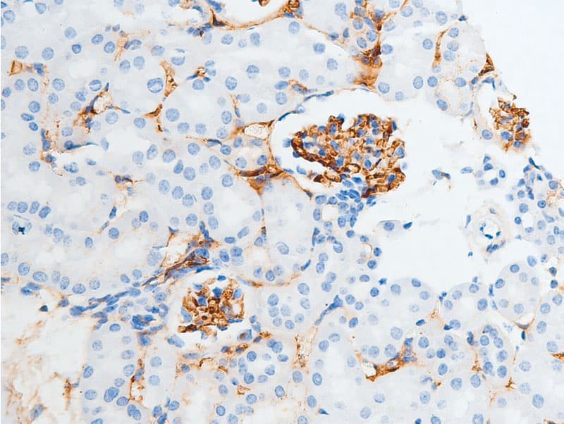 CHEK2 / CHK2 Antibody (phospho-Ser516)
