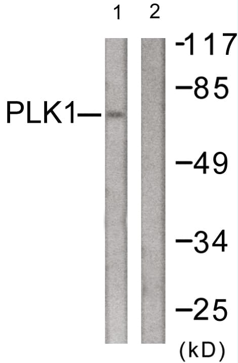 PLK1 / PLK-1 Antibody (aa176-225)