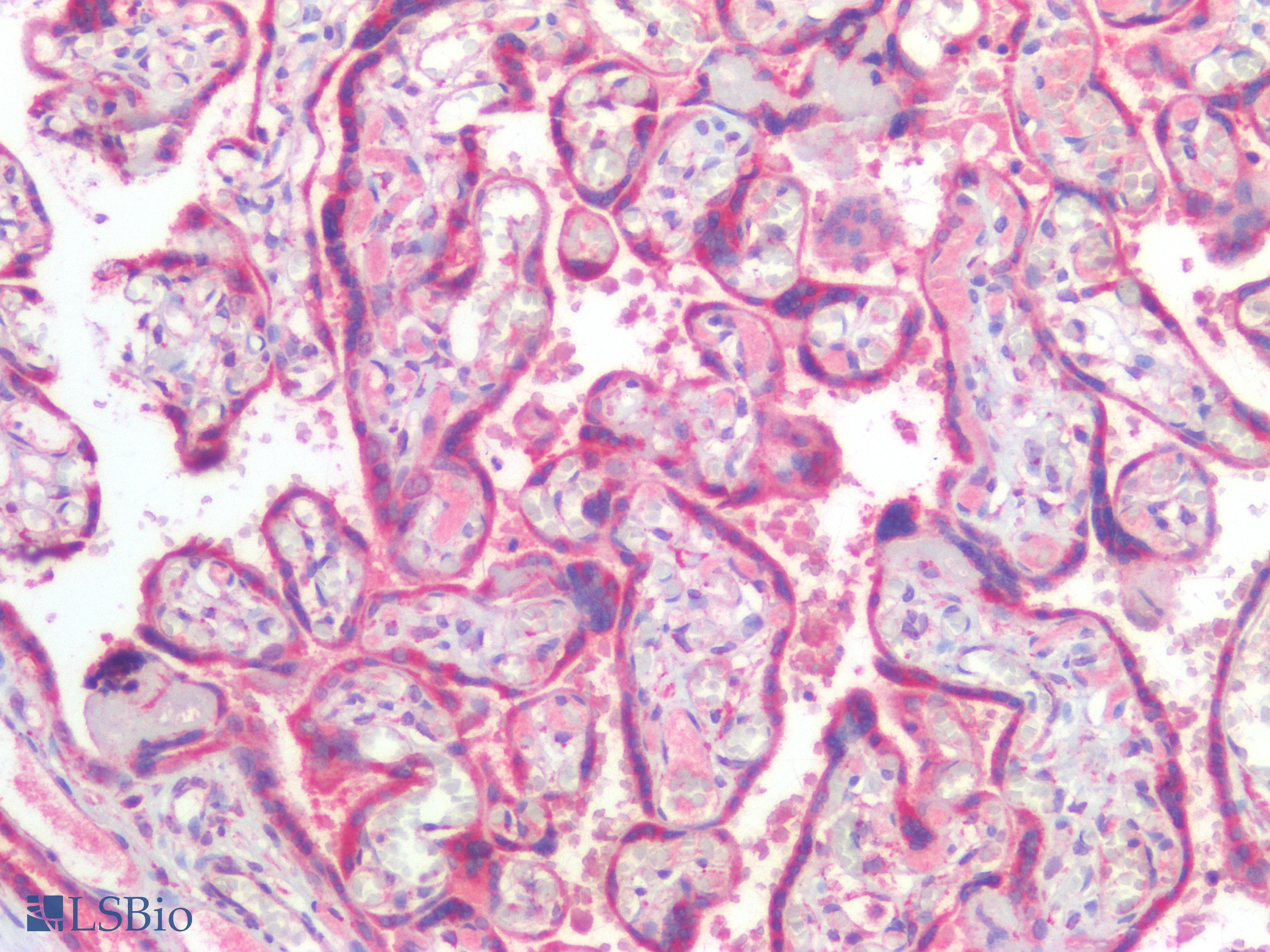 PathPlus™ Polyclonal Rabbit anti-Human IFIH1 / MDA5 Antibody (IHC)