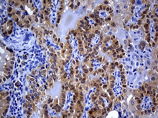 Monoclonal Mouse anti-Human PRDX5 / Peroxiredoxin 5 Antibody (clone OTI4B12, Carrier-free, IHC, WB)